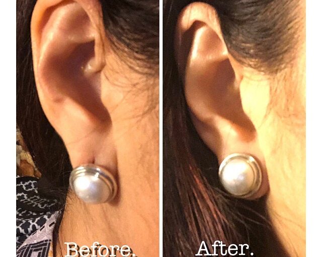 Julleen Lobe Lift Earring Backs come highly recommended